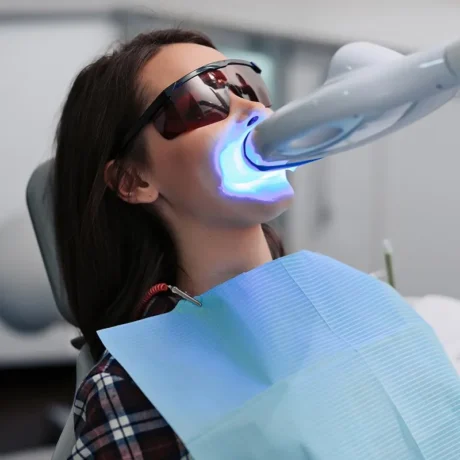in-office teeth whitening
